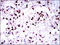 Rab proteins geranylgeranyltransferase component A 1 antibody, orb153343, Biorbyt, Immunohistochemistry paraffin image 