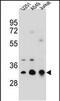 Tropomyosin 4 antibody, PA5-48443, Invitrogen Antibodies, Western Blot image 