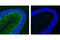 Mouse IgG antibody, 5415S, Cell Signaling Technology, Immunofluorescence image 