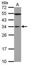 YEATS Domain Containing 4 antibody, GTX109088, GeneTex, Western Blot image 