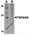 Tetraspanin 9 antibody, 5559, ProSci Inc, Western Blot image 