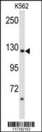Phospholipase C Beta 2 antibody, TA325098, Origene, Western Blot image 