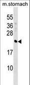 Crystallin Beta A4 antibody, LS-C167066, Lifespan Biosciences, Western Blot image 