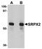 Sushi Repeat Containing Protein X-Linked 2 antibody, A06268, Boster Biological Technology, Western Blot image 