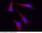 Keratin 5 antibody, 100312-T38, Sino Biological, Immunohistochemistry paraffin image 
