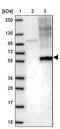 Solute Carrier Family 45 Member 3 antibody, PA5-53914, Invitrogen Antibodies, Western Blot image 