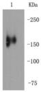 MER Proto-Oncogene, Tyrosine Kinase antibody, NBP2-67323, Novus Biologicals, Western Blot image 
