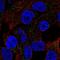 Chondrosarcoma Associated Gene 1 antibody, HPA078264, Atlas Antibodies, Immunocytochemistry image 