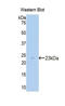 Carnitine Palmitoyltransferase 1A antibody, LS-C298051, Lifespan Biosciences, Western Blot image 