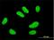 Ubiquitin-conjugating enzyme E2 E2 antibody, H00007325-M01, Novus Biologicals, Immunocytochemistry image 