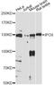 Importin 8 antibody, LS-C749668, Lifespan Biosciences, Western Blot image 