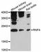 E3 ubiquitin ligase RNF4 antibody, LS-C747247, Lifespan Biosciences, Western Blot image 