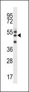 Regulator Of Microtubule Dynamics 2 antibody, LS-C158856, Lifespan Biosciences, Western Blot image 