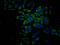 Eukaryotic Translation Initiation Factor 4A1 antibody, CSB-RA190088A0HU, Cusabio, Immunofluorescence image 