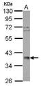 RNA Polymerase III Subunit F antibody, PA5-28314, Invitrogen Antibodies, Western Blot image 