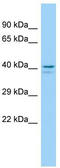 G Protein-Coupled Receptor 45 antibody, TA332010, Origene, Western Blot image 