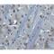 Bruton Tyrosine Kinase antibody, LS-C455, Lifespan Biosciences, Immunohistochemistry frozen image 