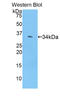 Cadherin-3 antibody, LS-C303378, Lifespan Biosciences, Western Blot image 