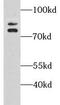 ERF3A antibody, FNab03680, FineTest, Western Blot image 