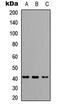 HLA class I histocompatibility antigen, A-68 alpha chain antibody, MBS8207040, MyBioSource, Western Blot image 