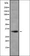 Keratin 76 antibody, orb337805, Biorbyt, Western Blot image 