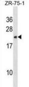 C-X-C Motif Chemokine Ligand 2 antibody, abx030670, Abbexa, Western Blot image 