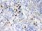 Matrix Metallopeptidase 8 antibody, PB9727, Boster Biological Technology, Immunohistochemistry paraffin image 