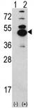 Calcium/Calmodulin Dependent Protein Kinase ID antibody, AP17173PU-N, Origene, Western Blot image 