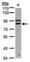 FAST Kinase Domains 1 antibody, LS-C185917, Lifespan Biosciences, Western Blot image 