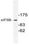 Eukaryotic Translation Initiation Factor 5B antibody, AP21063PU-N, Origene, Western Blot image 