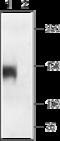 Calcium Voltage-Gated Channel Subunit Alpha1 S antibody, GTX16634, GeneTex, Western Blot image 