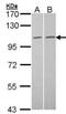 Tubulin Gamma Complex Associated Protein 2 antibody, NBP2-53097, Novus Biologicals, Western Blot image 