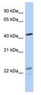 Branched Chain Keto Acid Dehydrogenase E1 Subunit Alpha antibody, ab90691, Abcam, Western Blot image 