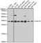 C-Type Lectin Domain Containing 7A antibody, STJ111925, St John
