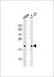Ferritin Heavy Chain 1 antibody, 62-861, ProSci, Western Blot image 
