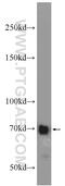 Galectin 3 Binding Protein antibody, 23307-1-AP, Proteintech Group, Western Blot image 