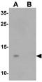 Yippee Like 5 antibody, GTX32065, GeneTex, Western Blot image 