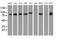 Diacylglycerol kinase beta antibody, MA5-25167, Invitrogen Antibodies, Western Blot image 