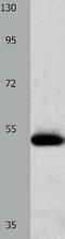 Stromelysin-2 antibody, TA321483, Origene, Western Blot image 
