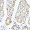 Mitochondrial Ribosomal Protein L11 antibody, LS-C333716, Lifespan Biosciences, Immunohistochemistry frozen image 
