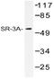 5-Hydroxytryptamine Receptor 3A antibody, AP20471PU-N, Origene, Western Blot image 
