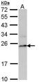 Proteasome Subunit Beta 8 antibody, GTX113533, GeneTex, Western Blot image 