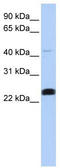 Lysocardiolipin Acyltransferase 1 antibody, TA335289, Origene, Western Blot image 
