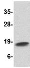 Cathelicidin Antimicrobial Peptide antibody, ab69484, Abcam, Western Blot image 