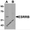 Steroid hormone receptor ERR2 antibody, 6813, ProSci Inc, Western Blot image 