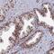 Netrin receptor UNC5D antibody, PA5-60168, Invitrogen Antibodies, Immunohistochemistry paraffin image 
