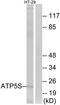 Distal Membrane Arm Assembly Complex 2 Like antibody, TA315368, Origene, Western Blot image 