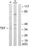 TEF Transcription Factor, PAR BZIP Family Member antibody, GTX87608, GeneTex, Western Blot image 