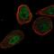 CHM Like Rab Escort Protein antibody, NBP2-76560, Novus Biologicals, Immunofluorescence image 