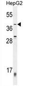 Zinc Finger Protein 763 antibody, AP54716PU-N, Origene, Western Blot image 